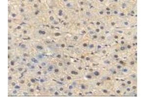 IHC-P analysis of Human Liver Tissue, with DAB staining. (HSP70 1A 抗体  (AA 1-641))