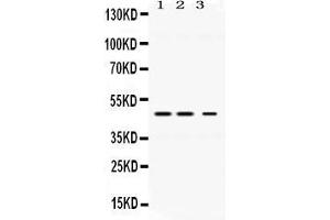Western blot analysis of Perilipin 3 expression in rat liver extract ( Lane 1), mouse kidney extract ( Lane 2) and HELA whole cell lysates ( Lane 3). (PLIN3 抗体  (C-Term))
