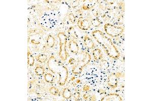 Immunohistochemistry of paraffin embedded mouse ischemic kidney using MUC20 (ABIN7074692) at dilution of 1:1000 (400x lens) (MUC20 抗体)