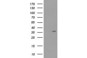Image no. 1 for anti-Short Chain Dehydrogenase/reductase Family 9C, Member 7 (SDR9C7) antibody (ABIN1500848) (SDR9C7 抗体)
