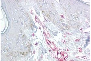 Anti-LIF antibody IHC staining of human skin. (LIF 抗体  (Internal Region))