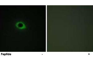 Immunofluorescence analysis of COS-7 cells, using TNS3 polyclonal antibody . (TNS3 抗体)