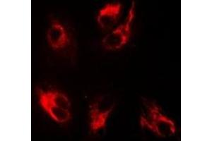 Immunofluorescence (IF) image for anti-Bone Morphogenetic Protein Receptor, Type IB (BMPR1B) antibody (ABIN7307574)