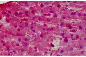 Human Liver: Formalin-Fixed, Paraffin-Embedded (FFPE) (Glutathione Peroxidase 1 抗体  (AA 127-193))