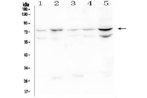 Western blot analysis of OLMF4 using anti-OLMF4 antibody (ABIN6719350). (Olfactomedin 4 抗体  (AA 91-510))