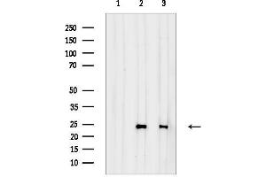 anti-Cerebellin 2 Precursor (CBLN2) (N-Term) antibody