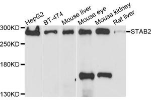 Western blot analysis of extracts of various cell lines, using STAB2 antibody. (Stabilin 2 (STAB2) 抗体)