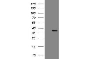 Image no. 1 for anti-Snail Family Zinc Finger 2 (SNAI2) antibody (ABIN1500987) (SLUG 抗体)