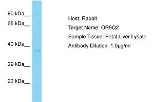 Western Blotting (WB) image for anti-Olfactory Receptor, Family 9, Subfamily Q, Member 2 (OR9Q2) (C-Term) antibody (ABIN2791800)