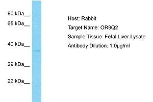 Host: Rabbit Target Name: OR9Q2 Sample Type: Fetal Liver lysates Antibody Dilution: 1. (OR9Q2 抗体  (C-Term))