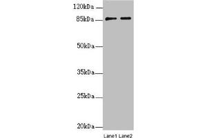 Western blot All lanes: SUPT20H antibody at 0. (SUPT2H (AA 580-779) 抗体)