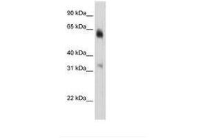 Image no. 3 for anti-Lysine (K)-Specific Demethylase 4D (KDM4D) (C-Term) antibody (ABIN6736292) (JMJD2D 抗体  (C-Term))