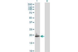 Western Blot analysis of ARF5 expression in transfected 293T cell line by ARF5 monoclonal antibody (M02), clone 1B6. (ARF5 抗体  (AA 81-180))