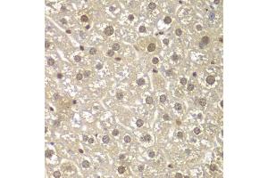 Immunohistochemistry of paraffin-embedded mouse liver using MAD1L1 antibody (ABIN5970500) at dilution of 1/100 (40x lens). (MAD1L1 抗体)