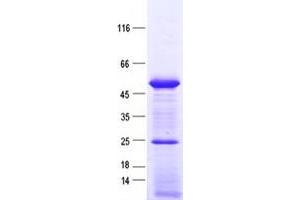 Western Blotting (WB) image for Small Nuclear RNA Activating Complex, Polypeptide 3, 50kDa (SNAPC3) protein (His tag) (ABIN2732313)