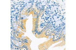 Immunohistochemistry (Paraffin-embedded Sections) (IHC (p)) image for anti-ATPase, H+/K+ Transporting, Nongastric, alpha Polypeptide (ATP12A) antibody (ABIN7073160)