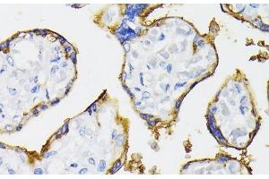 Immunohistochemistry of paraffin-embedded Human placenta using NT5E / CD73 Polyclonal Antibody at dilution of 1:200 (40x lens). (CD73 抗体)