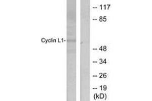 Western blot analysis of extracts from HepG2 cells, using Cyclin L1 Antibody. (Cyclin L1 抗体  (AA 461-510))