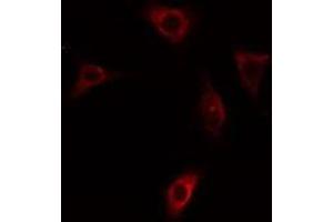 ABIN6275411 staining HepG2 cells by IF/ICC. (PPP1R3C 抗体  (N-Term))