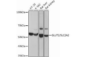 Western blot analysis of extracts of various cell lines, using GLUT2/SLC2 Rabbit mAb (ABIN7270414) at 1:3000 dilution. (SLC2A2 抗体)