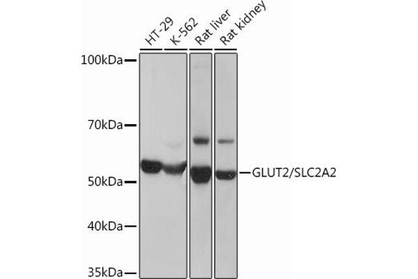 SLC2A2 抗体