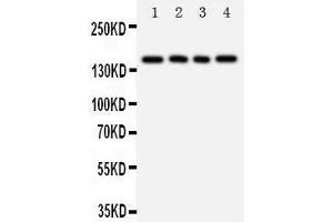 Western Blotting (WB) image for anti-Tenascin R (Restrictin, Janusin) (TNR) (AA 104-117), (N-Term) antibody (ABIN3044266) (Tenascin R 抗体  (N-Term))