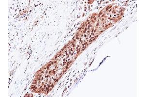 IHC-P Image Immunohistochemical analysis of paraffin-embedded H1299 xenograft, using Proteasome 20S alpha 5, antibody at 1:100 dilution. (PSMA5 抗体  (Center))