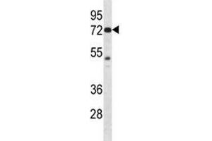 Pak4 antibody western blot analysis in mouse Neuro-2a lysate (PAK4 抗体  (AA 187-216))