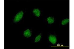 Immunofluorescence of purified MaxPab antibody to TRIM45 on HeLa cell. (TRIM45 抗体  (AA 1-562))