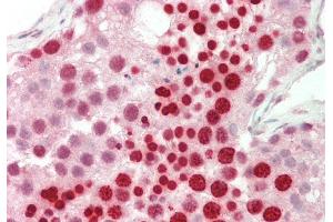 Rabbit Anti-RBPMS antibody  Formalin Fixed Paraffin Embedded Tissue: Human Testis Primary antibody Concentration: 1:100 Secondary Antibody: Donkey anti-Rabbit-Cy3 Secondary Antibody Concentration: 1:200 Magnification: 20x Exposure Time: 0. (RBPMS 抗体  (N-Term))