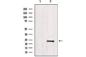 Western blot analysis of extracts from 293, using SM22 aphla Antibody. (Transgelin 抗体  (C-Term))