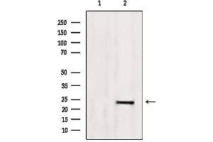 Western blot analysis of extracts from 293, using SM22 aphla Antibody. (Transgelin 抗体  (C-Term))