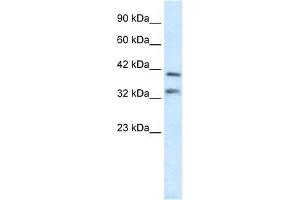 Human Liver; WB Suggested Anti-GSH2 Antibody Titration: 0. (GSX2 抗体  (N-Term))