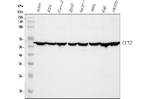 Western blot analysis of CCT2 using anti-CCT2 antibody (ABIN4886512).