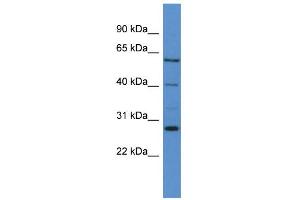 WB Suggested Anti-CYP24A1 Antibody Titration: 0. (CYP24A1 抗体  (C-Term))