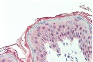 Human, Skin: Formalin-Fixed Paraffin-Embedded (FFPE) (DEGS1 抗体  (N-Term))