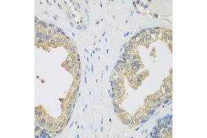 Immunohistochemistry of paraffin-embedded human prostate using ENPEP antibody at dilution of 1:200 (40x lens). (ENPEP 抗体)
