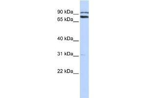WB Suggested Anti-TRIM67 Antibody Titration:  0. (TRIM67 抗体  (C-Term))