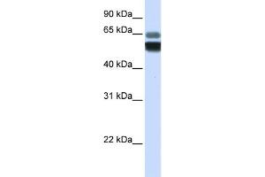 WB Suggested Anti-SMPD1 Antibody Titration:  0. (SMPD1 抗体  (Middle Region))