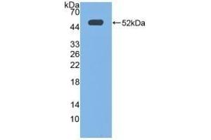 Western Blotting (WB) image for anti-Prostaglandin E Receptor 3 (Subtype EP3) (PTGER3) (AA 217-390) antibody (ABIN7442219)