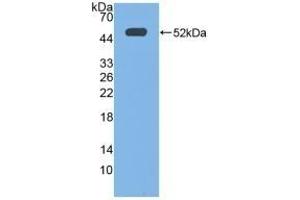 Detection of Recombinant EP3, Human using Polyclonal Antibody to Prostaglandin E Receptor 3 (EP3) (PTGER3 抗体  (AA 217-390))
