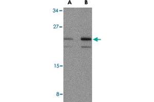 Western blot analysis of IL23A in mouse pancreas tissue lysate with IL23A polyclonal antibody  at (A) 1 and (B) 2 ug/mL . (IL23A 抗体  (N-Term))