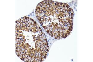 Immunohistochemistry of paraffin-embedded mouse testis using PRMT5 antibody (ABIN7269605) at dilution of 1:100 (40x lens). (PRMT5 抗体)