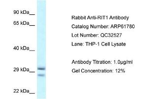 Western Blotting (WB) image for anti-Ras-Like Without CAAX 1 (RIT1) (Middle Region) antibody (ABIN2774323) (RIT1 抗体  (Middle Region))