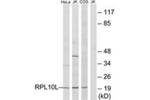 Western blot analysis of extracts from Jurkat/COS7/HeLa cells, using RPL10L Antibody. (RPL10L 抗体  (AA 151-200))