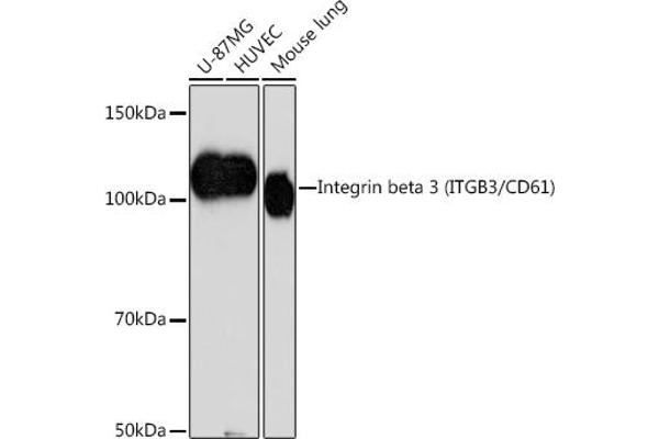 Integrin beta 3 抗体