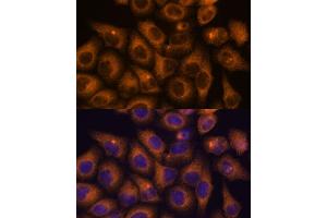 Immunofluorescence analysis of HeLa cells using CAMKV antibody (ABIN7266051) at dilution of 1:100. (CAMKV 抗体  (AA 1-285))