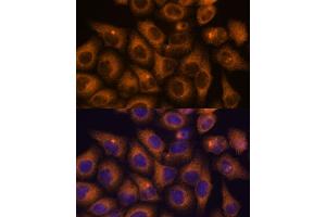 Immunofluorescence analysis of HeLa cells using CAMKV antibody (ABIN7266051) at dilution of 1:100. (CAMKV 抗体  (AA 1-285))
