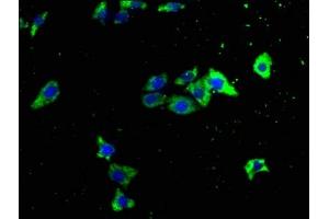 Immunofluorescence staining of HepG2 cells with ABIN7151041 at 1:133, counter-stained with DAPI. (ITCH 抗体  (AA 29-303))