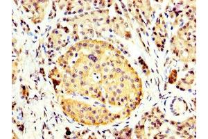IHC image of ABIN7153687 diluted at 1:400 and staining in paraffin-embedded human pancreatic tissue performed on a Leica BondTM system. (CCKBR 抗体  (AA 243-333))